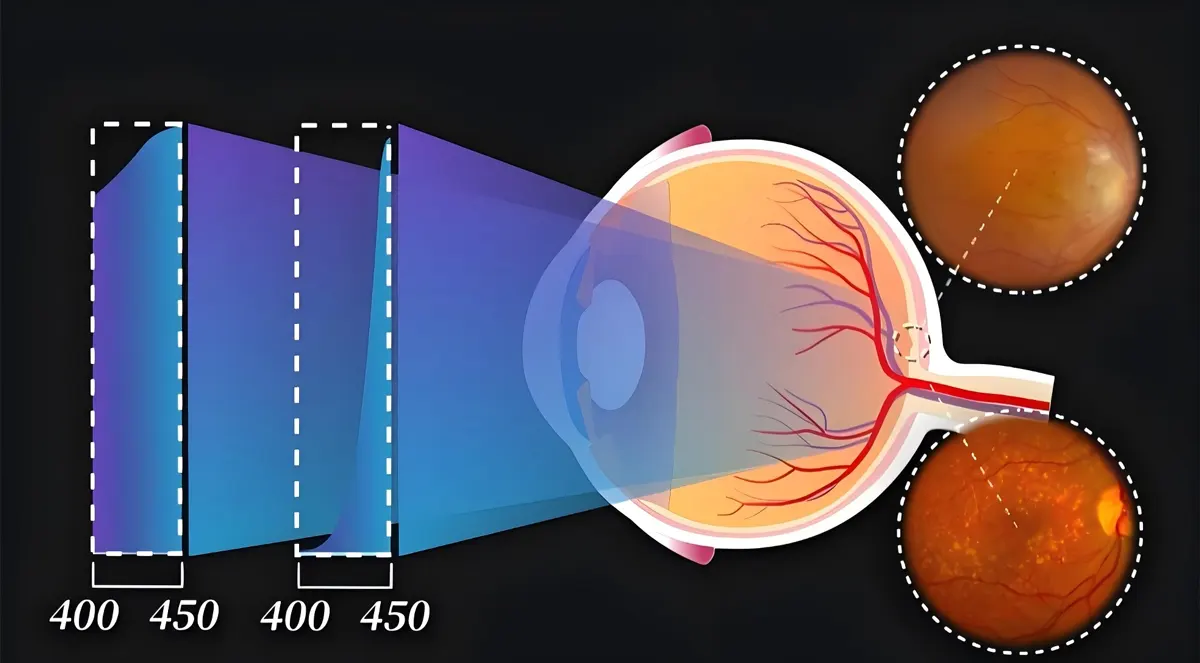 What is blue light and Why is blue light hazard a major concern